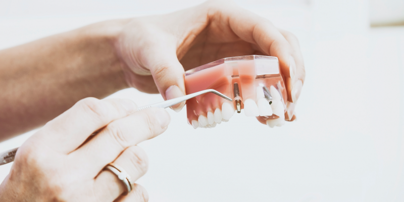 5 Ways Dental Implants Can Transform Your Smile Lipkowitz Dental Gloucester MA