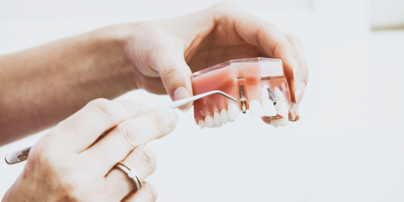 Understanding the Importance of Dental Implants Lipkowitz Dental